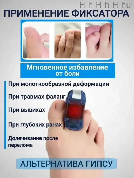 Жесткая лангетка-бандаж для фиксации пальца ноги универсальн, вариант, фото 2