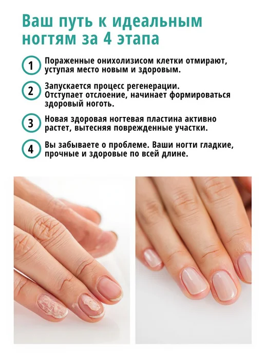 Масло монарды от онихолизиса и грибка ONYCHO DUO уход для и, вариант, фото 2