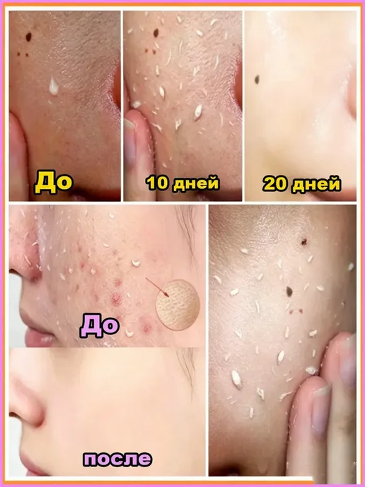 АкваЛиус Пилинг-скатка с витамином С для лица 100 г осветление тона, 100 г, фото 3
