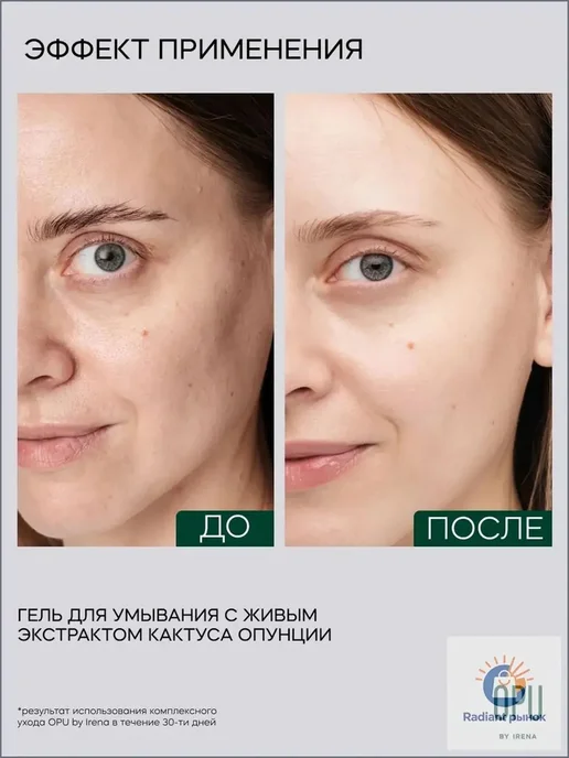 OPU by IRENA Гель для умывания лица, вариант, фото 2