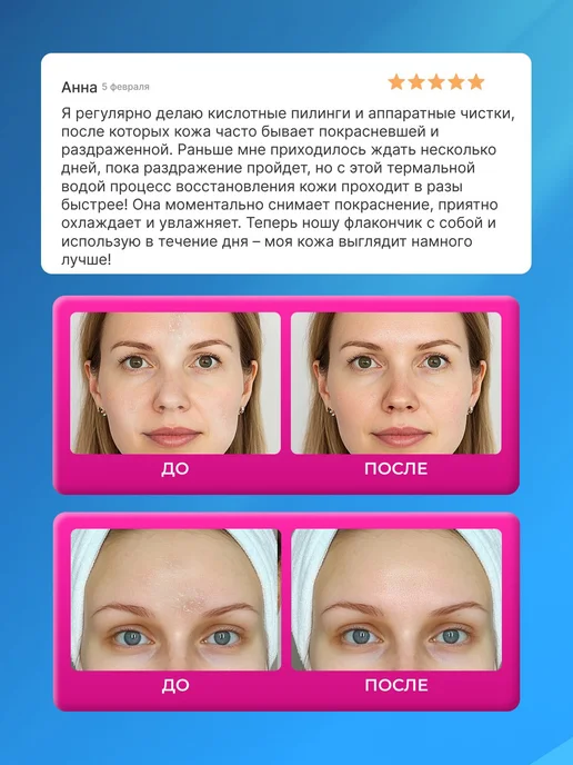 Тонер для лица термальная вода, увлажняющая, Iv.cos, вариант, фото 7