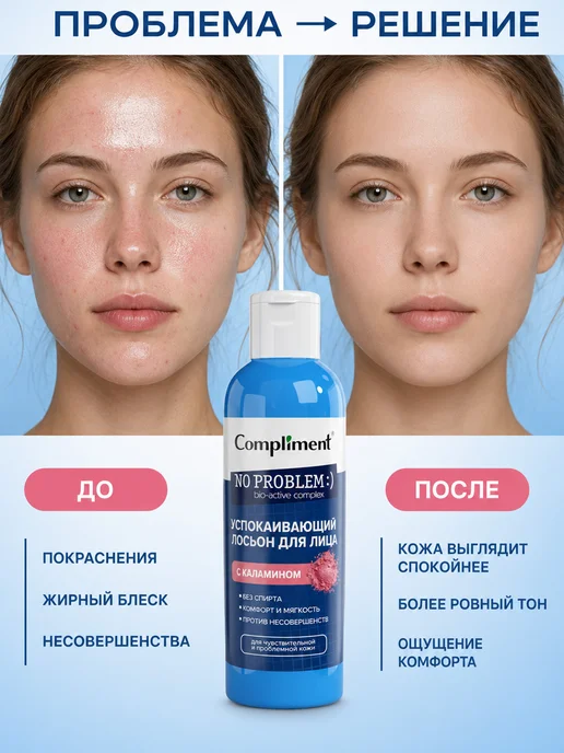 Compliment No Problem Лосьон для лица от прыщей с каламином, вариант, фото 2