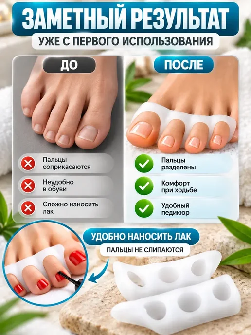 AIRUS03 Разделители для пальцев ног силиконовые для педикюра, белый, фото 3
