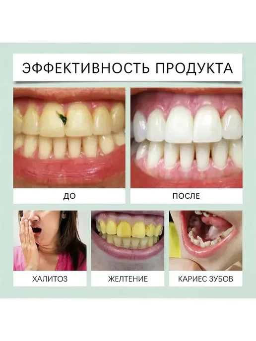 флосстик для зубов, вариант, фото 11