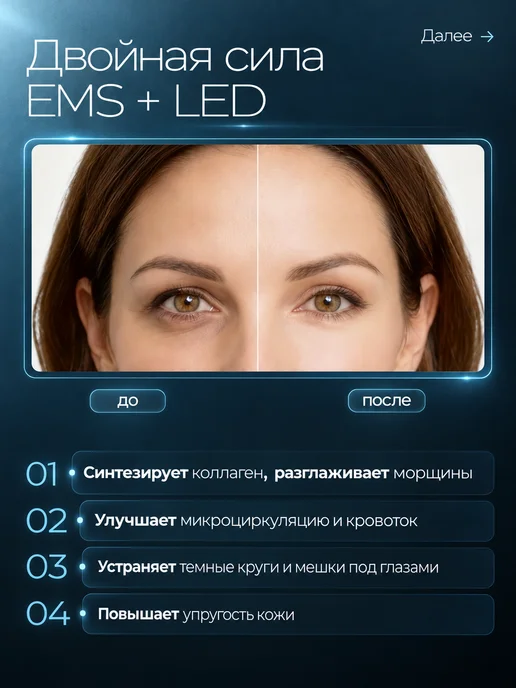 REFLY Микротоковый массажер очки для глаз и лица EMS LED, белый, фото 3