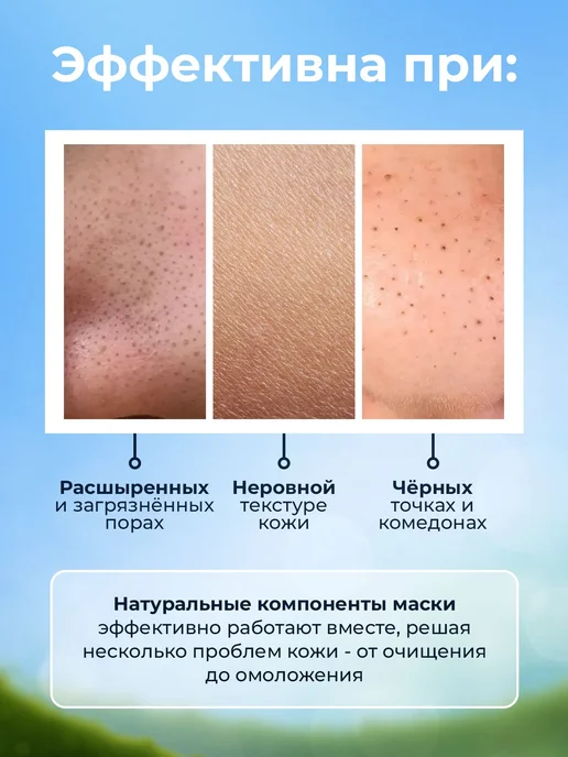 Skin Helpers Противовоспалительная маска от черных точек, от, черный, фото 2