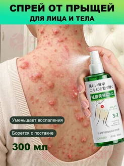 Спрейтоник для тела с азелаиновой кислотой, уход за проблемн