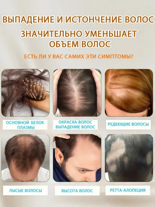 Спрей для волос предотвращает выпадение, увеличивает густоту, вариант, фото 2
