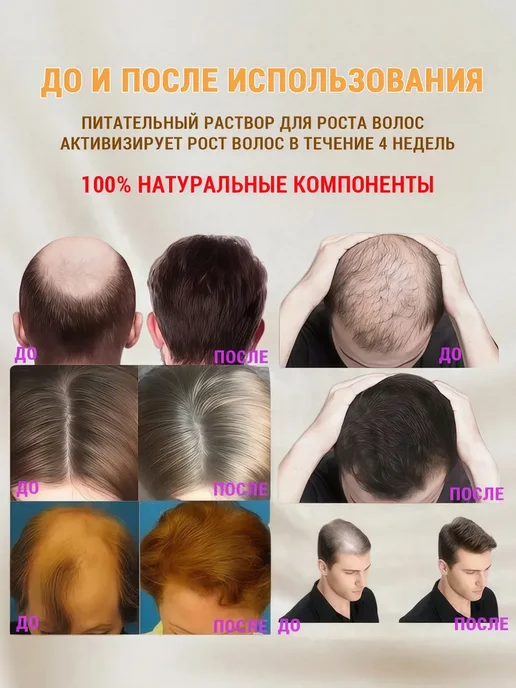 Спрей для волос предотвращает выпадение, увеличивает густоту, вариант, фото 3