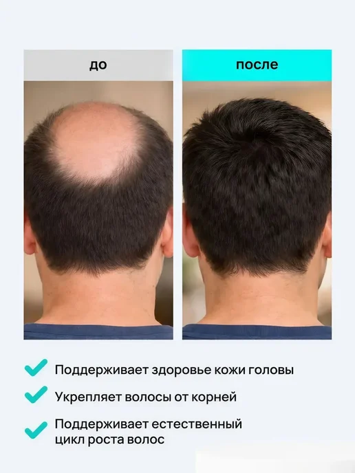 Спрей для волос предотвращает выпадение, увеличивает густоту, вариант, фото 4