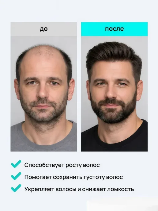 Спрей для волос предотвращает выпадение, увеличивает густоту, вариант, фото 5