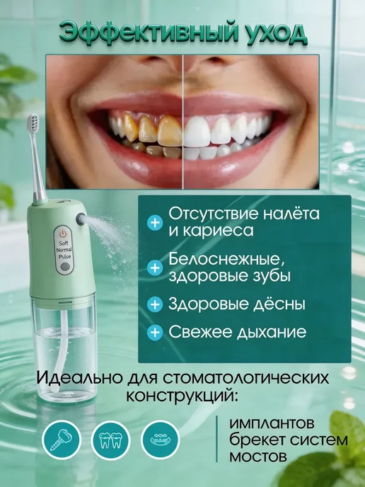 Беспроводной ирригатор для зубов, дорожный, USB зарядка, зеленый, фото 6
