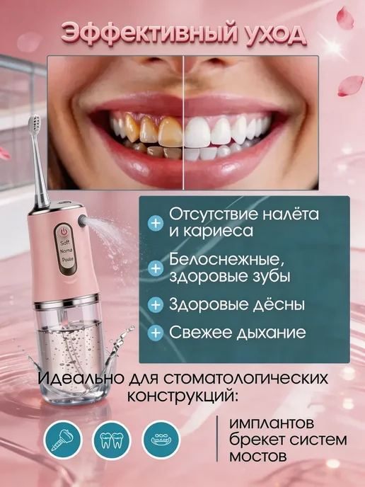 Беспроводной ирригатор для зубов, дорожный, USB зарядка, розовый, фото 4