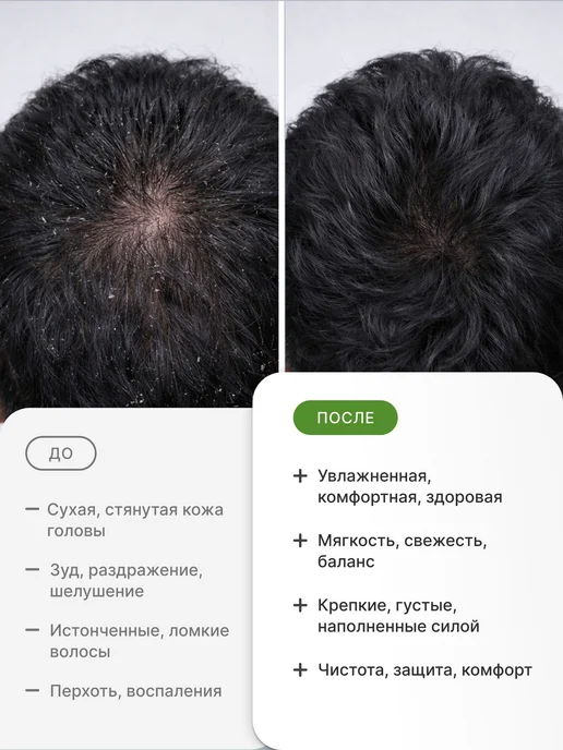 Шампунь и кондиционер SCALPD Organic DRY 2x350 мл, для сухой, 2x350, 350 мл, фото 2