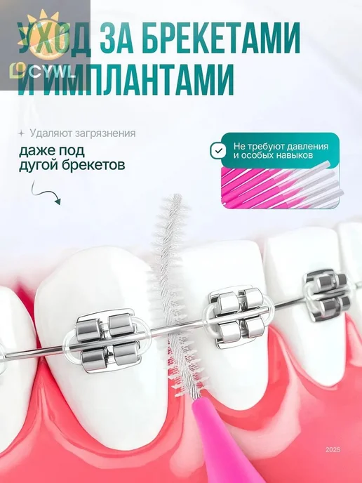 Ершики межзубные для брекетов 60шт, 60 шт, фото 7