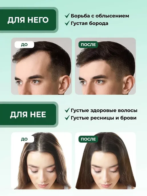 LEAMO Масло розмарина активатор роста для волос 100 мл, для, 100 мл, фото 4