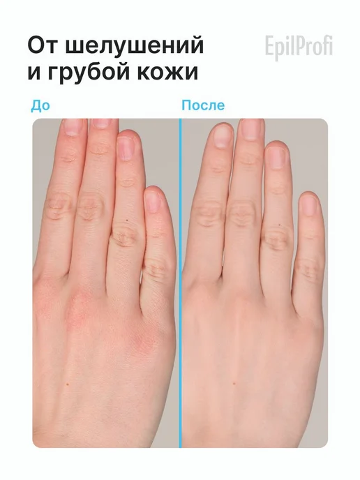 EpilProfi Крем воск от трещин для очень сухой кожи рук и для, вариант, фото 2
