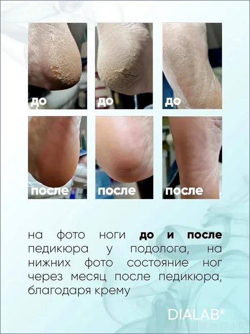 Крем для ног с мочевиной 40 %, 200 мл, 200 мл, фото 2