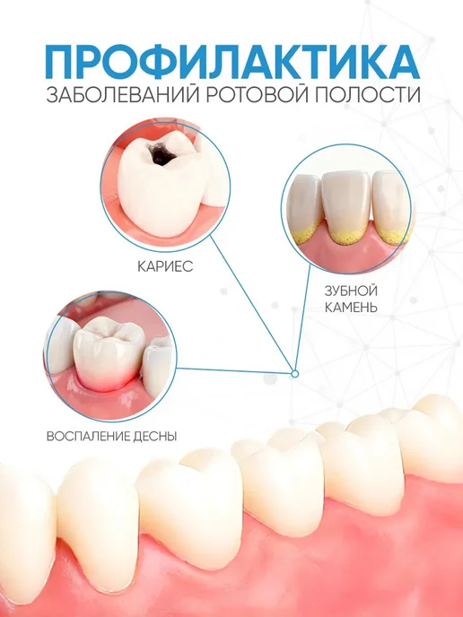 Межзубные ершики L для брекетов, 6 шт, 6 шт, фото 5