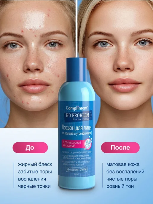 Compliment No Problem Лосьон для лица с салициловой кислотой, вариант, фото 2