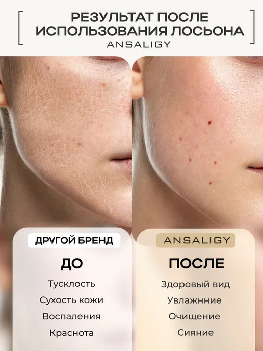 Лосьон для лица очищающий увлажняющий тоник для 200, вариант, фото 4