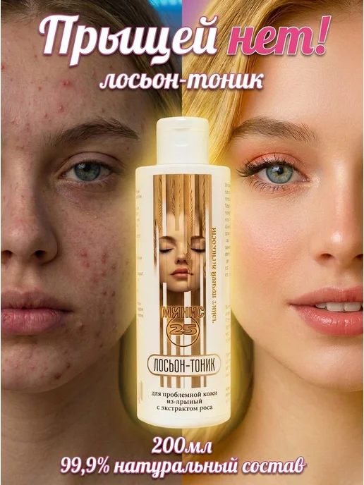 Лосьон женский для проблемной кожи от прыщей и камедонов для, вариант