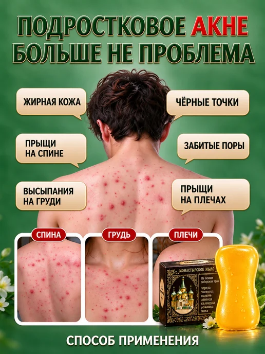 Мыло от подростковых прыщей, вариант, фото 5