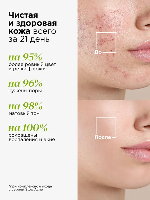 Тоник для лица очищающий с кислотами для проблемной, вариант, фото 2