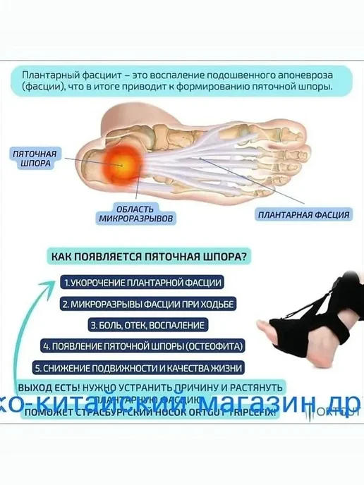 Ночной страсбургский носок для пяточной шпоры, вариант, фото 4