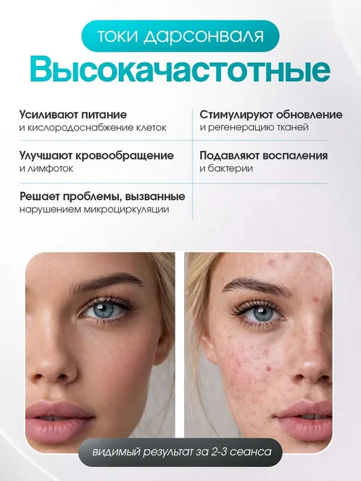 Аппарат для косметических процедур, 30 Вт, 30 Вт, фото 6