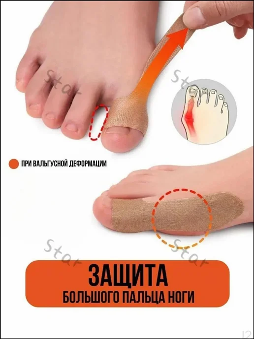Тейп кинезио от вальгуса стопы 2×8 см, 2x8 см, фото 3