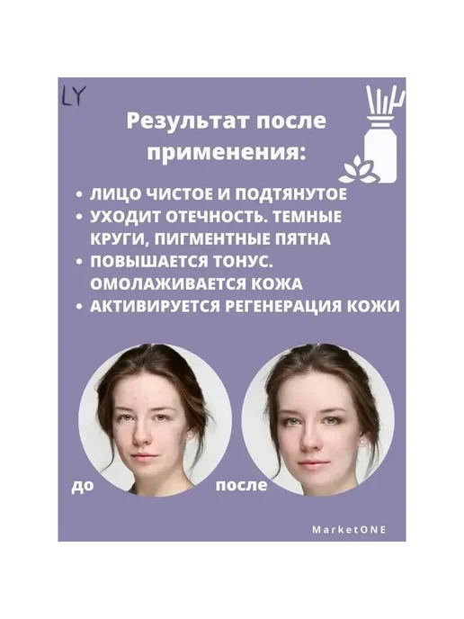 Дарсонваль для ухода за лицом 1 шт, 1 шт, фото 7