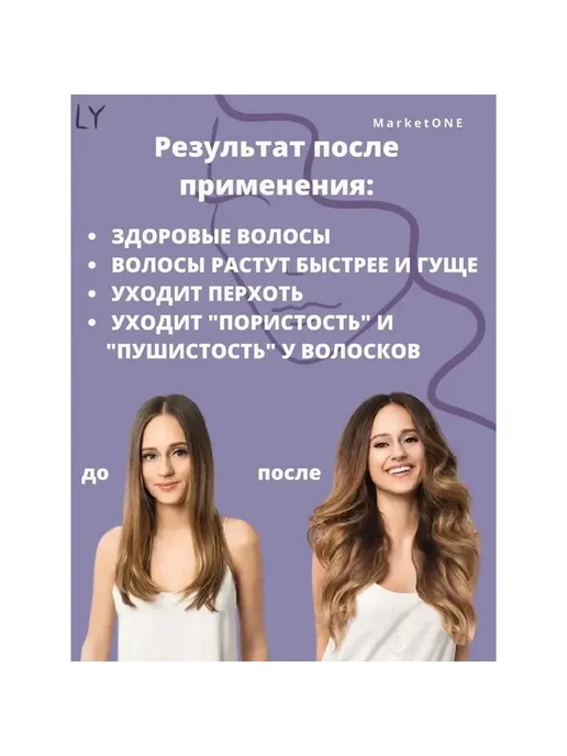 Дарсонваль для ухода за лицом 1 шт, 1 шт, фото 8